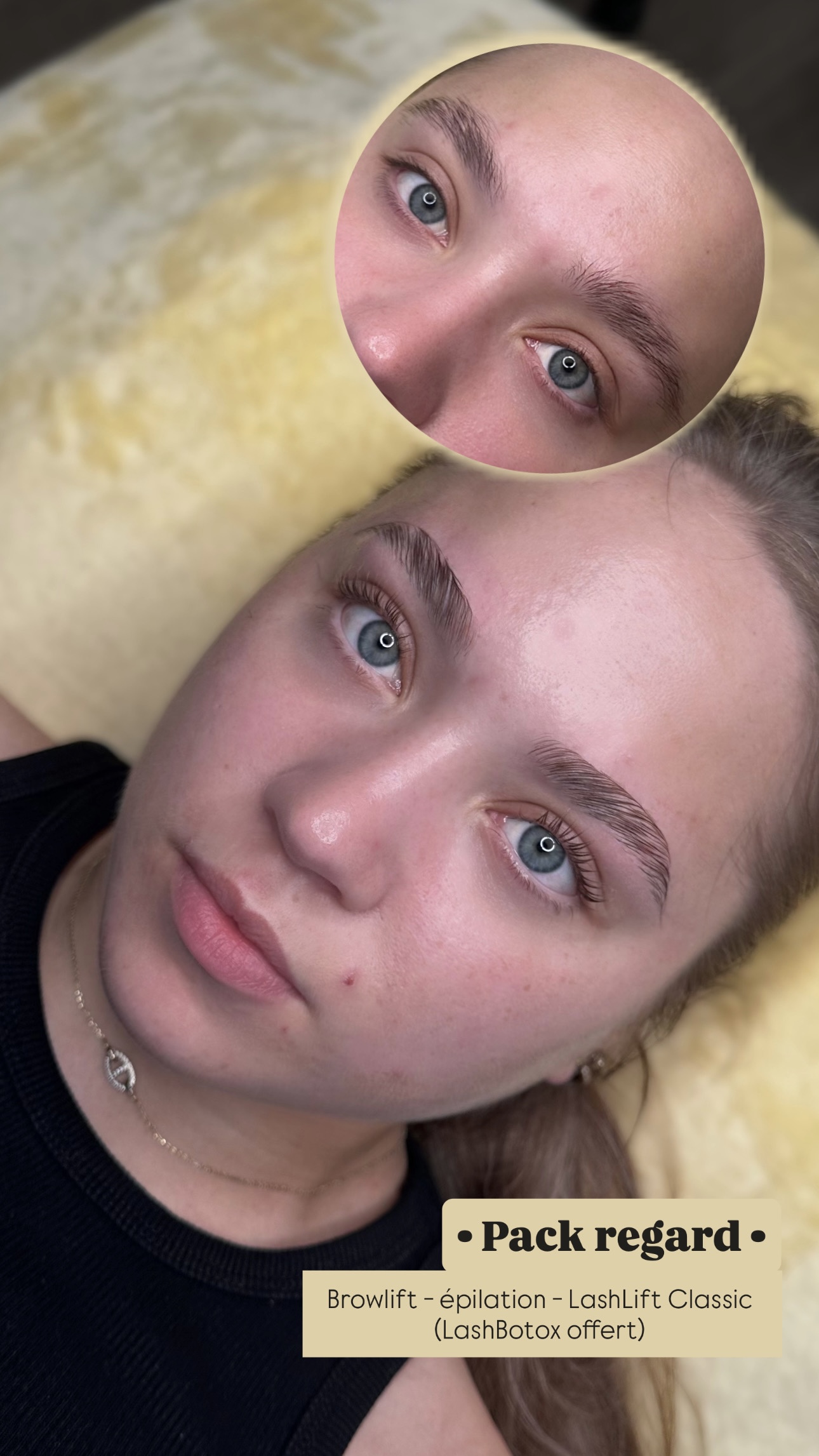 Browlift + Lashlift Classic 